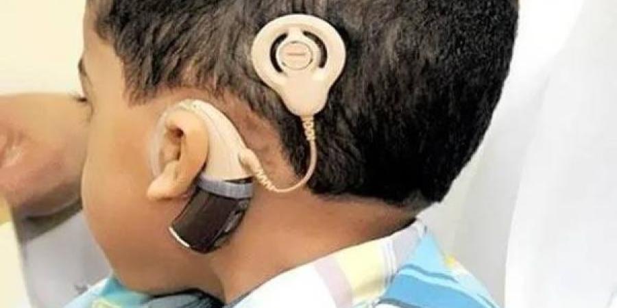 كلفتها تفوق 20 مليون سنتيم .. شركات التأمين ترفض تغطية زرع القوقعة لمعاقي السمع