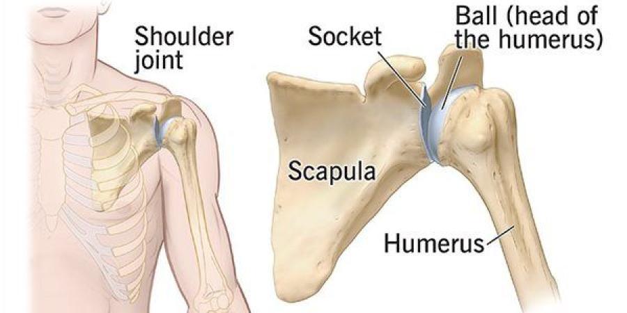 استبدال مفصل الكتف.. متى يكون الخيار الأنسب لعلاج الألم واستعادة الحركة؟