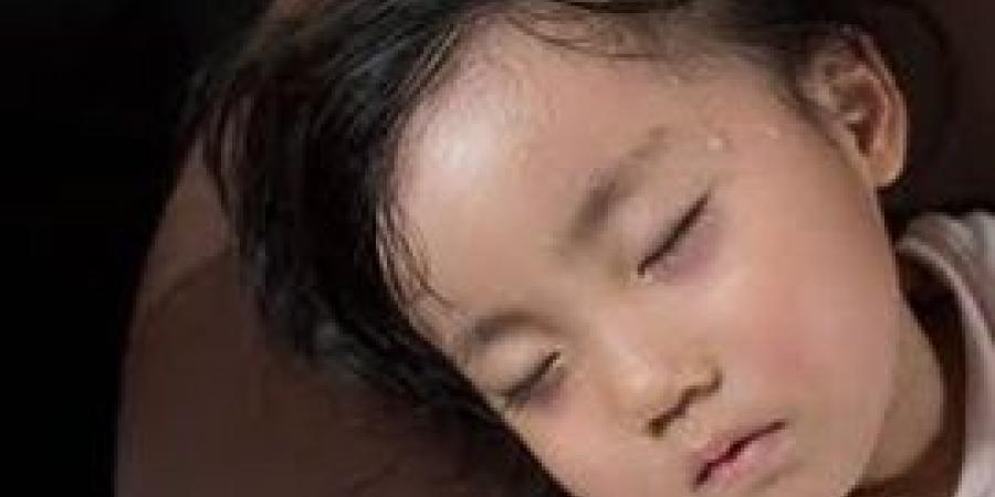 القضاء على مشكلة فرط التعرق لدى الأطفال حملة بمستشفى الأطفال ببنها