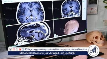 الصحة الاسرائيلية تعلن عن تسجيل إصابة بالتهاب دماغي ناتج عن أميبا نادرة