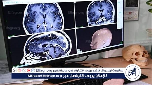 الصحة الاسرائيلية تعلن عن تسجيل إصابة بالتهاب دماغي ناتج عن أميبا نادرة